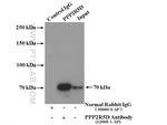 PPP2R5D Antibody in Immunoprecipitation (IP)