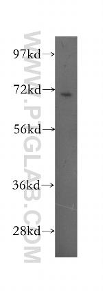 PPP2R5D Antibody in Western Blot (WB)