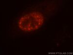 SF3A3 Antibody in Immunocytochemistry (ICC/IF)