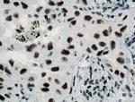 SF3A3 Antibody in Immunohistochemistry (Paraffin) (IHC (P))