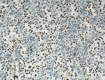 SF3A3 Antibody in Immunohistochemistry (Paraffin) (IHC (P))
