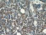 STAT5B Antibody in Immunohistochemistry (Paraffin) (IHC (P))