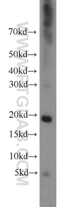 Cystatin F Antibody in Western Blot (WB)