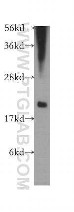 Cystatin F Antibody in Western Blot (WB)