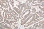 TRAPPC4 Antibody in Immunohistochemistry (Paraffin) (IHC (P))
