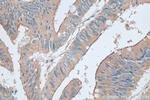 TRAPPC4 Antibody in Immunohistochemistry (Paraffin) (IHC (P))
