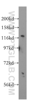 USP48 Antibody in Western Blot (WB)
