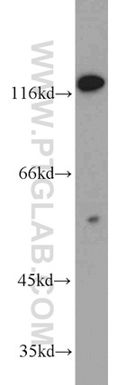USP48 Antibody in Western Blot (WB)