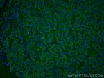 TINAGL1 Antibody in Immunohistochemistry (PFA fixed) (IHC (PFA))