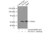 TINAGL1 Antibody in Immunoprecipitation (IP)