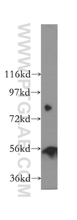 TINAGL1 Antibody in Western Blot (WB)
