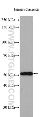 TINAGL1 Antibody in Western Blot (WB)