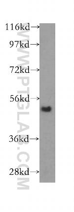 TINAGL1 Antibody in Western Blot (WB)