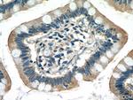 GNA15 Antibody in Immunohistochemistry (Paraffin) (IHC (P))