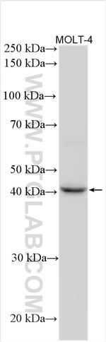 GNA15 Antibody in Western Blot (WB)