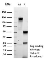 Colipase/CLPS Antibody in SDS-PAGE (SDS-PAGE)
