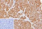 Colipase/CLPS Monoclonal Antibody (CLPS/9901)