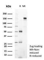 Colipase/CLPS Antibody in SDS-PAGE (SDS-PAGE)