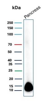 Colipase/CLPS Antibody in Western Blot (WB)