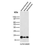Colipase/CLPS Antibody in Western Blot (WB)