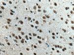NEUROD1 Antibody in Immunohistochemistry (Paraffin) (IHC (P))