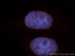 HMG20A Antibody in Immunocytochemistry (ICC/IF)