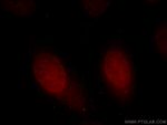 HMG20A Antibody in Immunocytochemistry (ICC/IF)