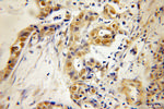 HMG20A Antibody in Immunohistochemistry (Paraffin) (IHC (P))