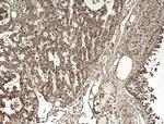 SLC25A10 Antibody in Immunohistochemistry (Paraffin) (IHC (P))