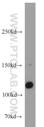 CDA1 Antibody in Western Blot (WB)