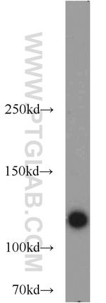CDA1 Antibody in Western Blot (WB)