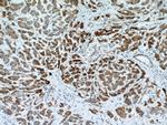 REEP6 Antibody in Immunohistochemistry (Paraffin) (IHC (P))