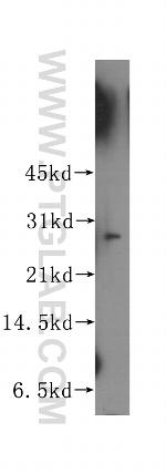 APIP Antibody in Western Blot (WB)