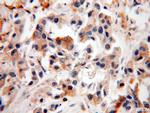 SRPR Antibody in Immunohistochemistry (Paraffin) (IHC (P))