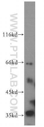 SRPR Antibody in Western Blot (WB)