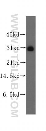 FKBP7 Antibody in Western Blot (WB)