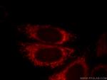 DNAJC19 Antibody in Immunocytochemistry (ICC/IF)