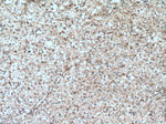 FEZ1 Antibody in Immunohistochemistry (Paraffin) (IHC (P))