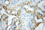 PBXIP1 Antibody in Immunohistochemistry (Paraffin) (IHC (P))