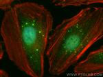 CNBP Antibody in Immunocytochemistry (ICC/IF)