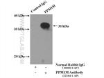 PPM1M Antibody in Immunoprecipitation (IP)