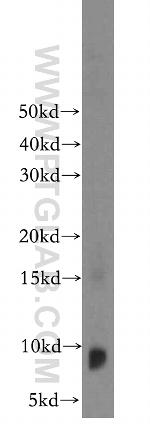 PTMS Antibody in Western Blot (WB)