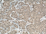 BCOR Antibody in Immunohistochemistry (Paraffin) (IHC (P))