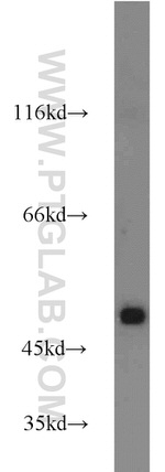 TRIM21 Antibody in Western Blot (WB)