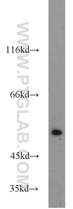 TRIM21 Antibody in Western Blot (WB)