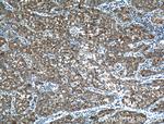 PTPN9 Antibody in Immunohistochemistry (Paraffin) (IHC (P))
