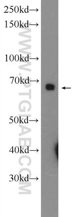 PTPN9 Antibody in Western Blot (WB)