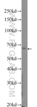 PTPN9 Antibody in Western Blot (WB)
