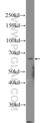 PTPN9 Antibody in Western Blot (WB)