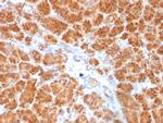 Clathrin, Light Chain Monoclonal Antibody (SPM174)
